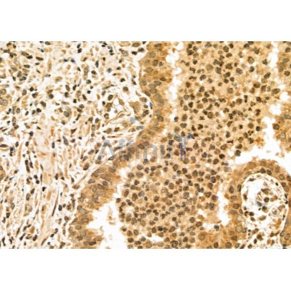 Валидация Affinity DF6929 - 18534