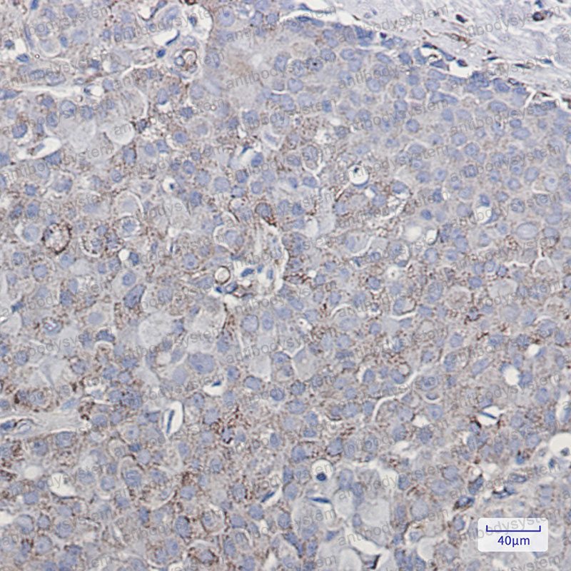 Валидация AntibodySystem RHE34705