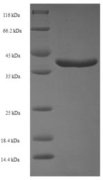 SDS-PAGE