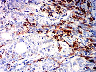 Валидация AntibodySystem RHD55204 (1637)