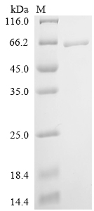 SDS-PAGE