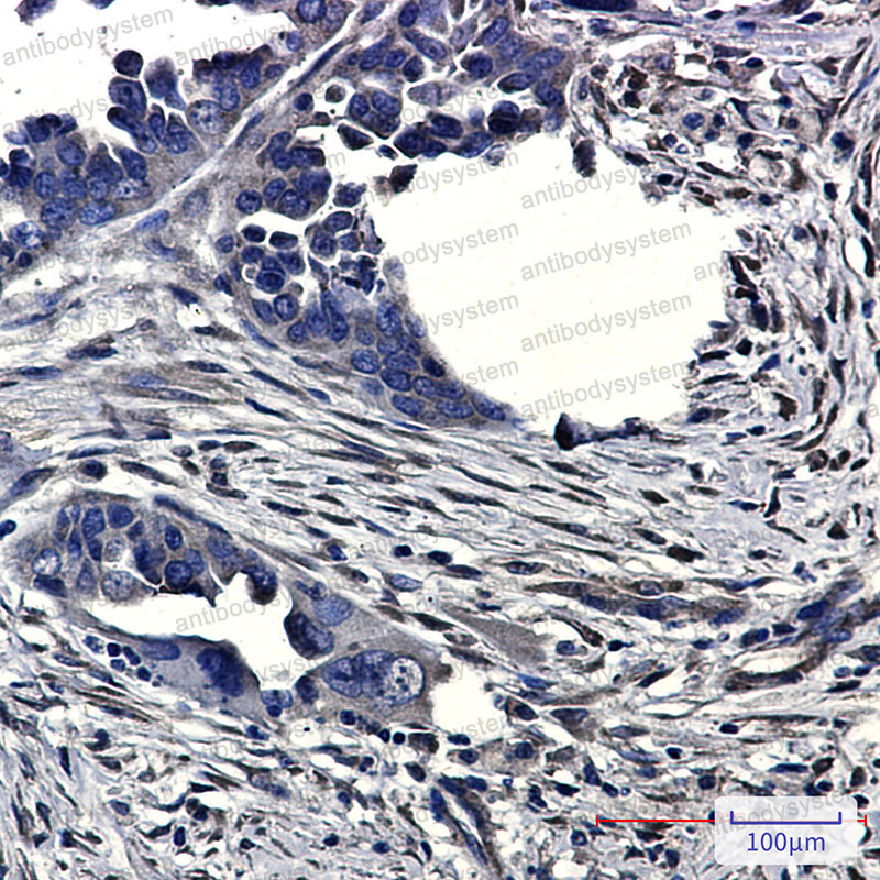Валидация AntibodySystem RHJ90901
