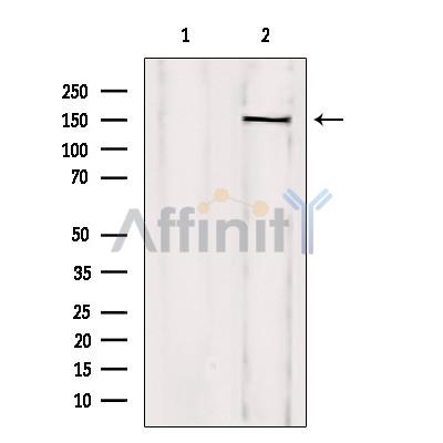 Валидация Affinity DF3261 - 14113