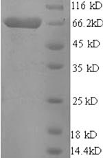 SDS-PAGE