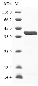 SDS-PAGE