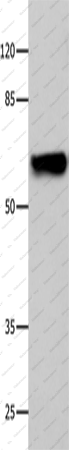 Вестерн-блоттинг, CNGA2, клетки 293T