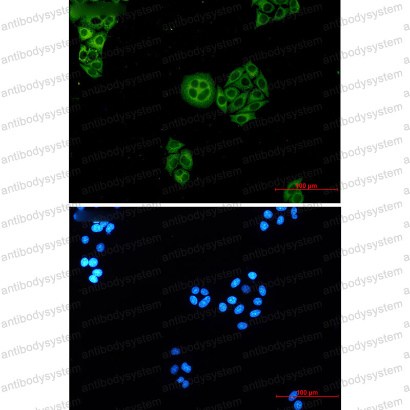 Валидация IF - AntibodySystem RHB08101