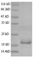 SDS-PAGE