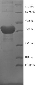 SDS-PAGE