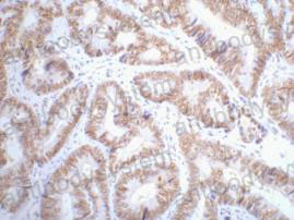 Валидация AntibodySystem RHC10013