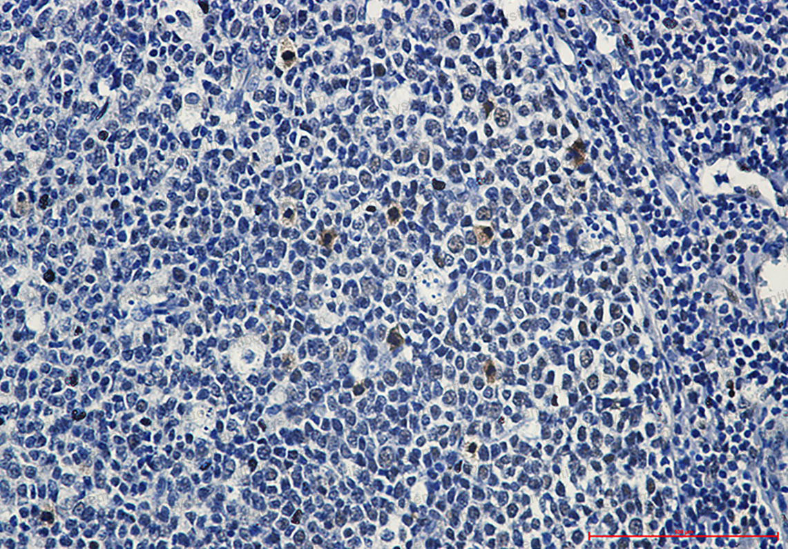 Валидация AntibodySystem RHC79702