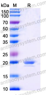 YHB91117, SDS-PAGE