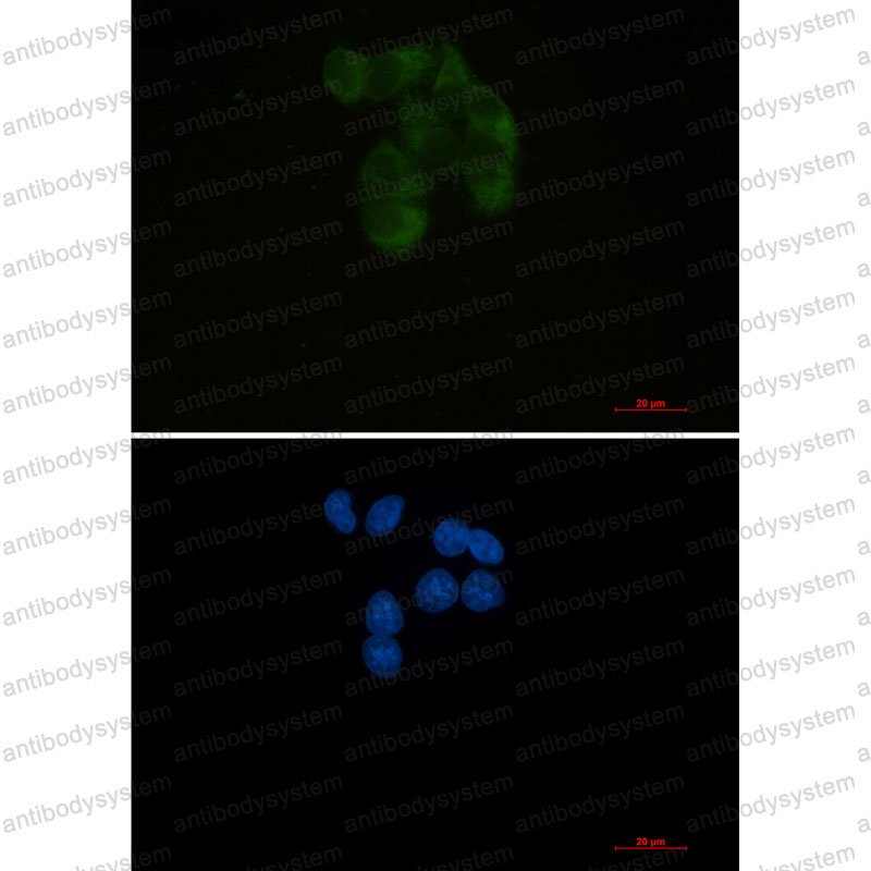 Валидация IF - AntibodySystem RHF61302