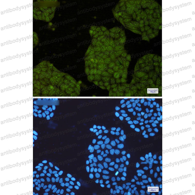 Валидация IF - AntibodySystem RHN65401