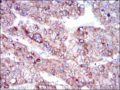 Валидация AntibodySystem RHN99801 (4054)