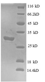 SDS-PAGE