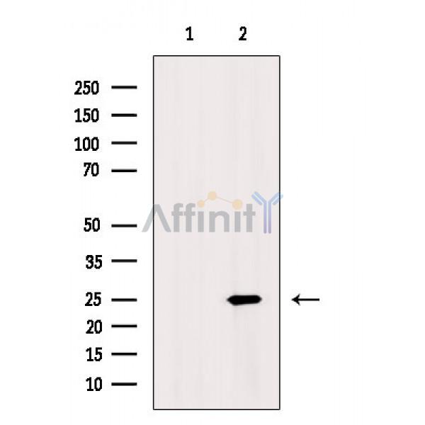Валидация Affinity AF3751 - 2040