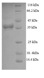 SDS-PAGE