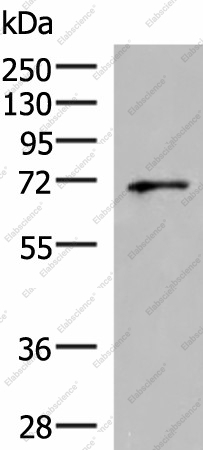 Вестерн-блоттинг, GSPT2, клетки PC3