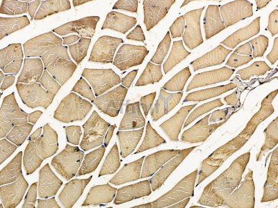 Валидация Affinity DF9185 - 21554