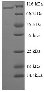 SDS-PAGE