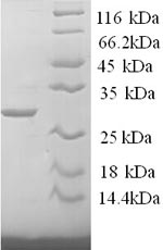 SDS-PAGE