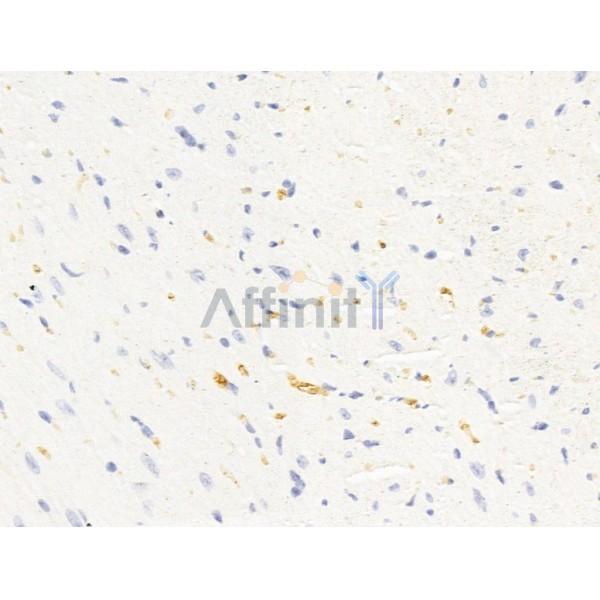 Валидация Affinity DF13634 - 9174