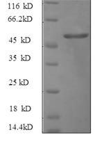 SDS-PAGE
