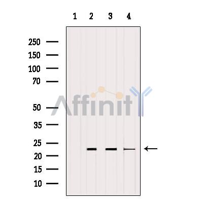 Валидация Affinity AF6352 - 3637