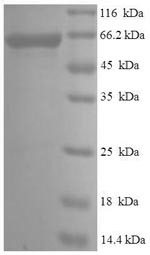 SDS-PAGE