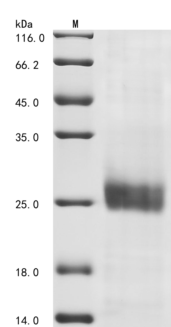SDS-PAGE