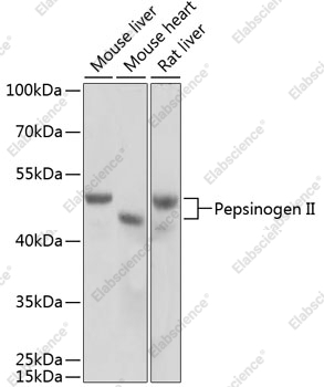 Вестерн-блоттинг, Pepsinogen II, различные клеточные линии
