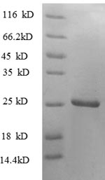 SDS-PAGE