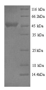 SDS-PAGE