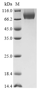 SDS-PAGE