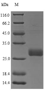 SDS-PAGE