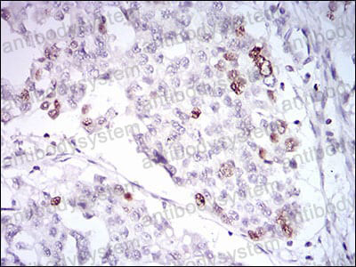 Валидация AntibodySystem RHH12601 (3184)