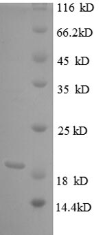 SDS-PAGE