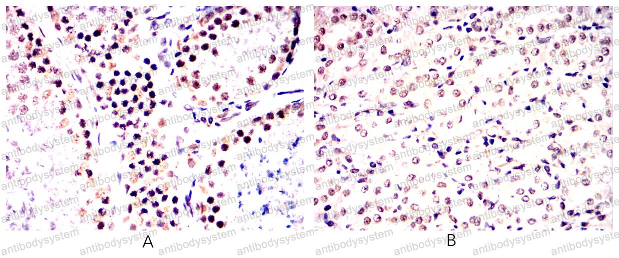 Валидация AntibodySystem RHF42902