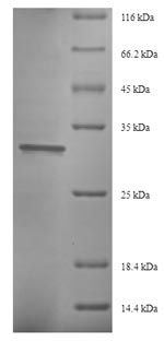 SDS-PAGE