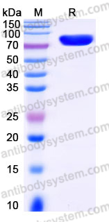AHJ41004, SDS-PAGE