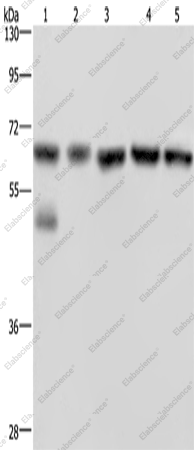 Вестерн-блоттинг, NUP62, клетки Jurkat, ткань злокачественной глиомы мозга человека, клетки PC3, K562 и A549