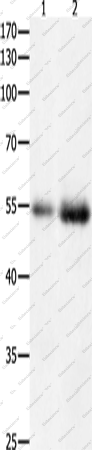 Вестерн-блоттинг, HDAC1, ткань рака толстой кишки и почки человека
