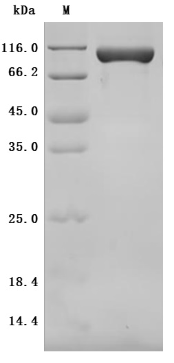 SDS-PAGE
