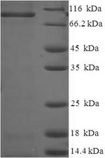 SDS-PAGE