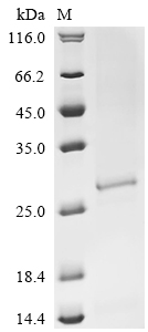SDS-PAGE