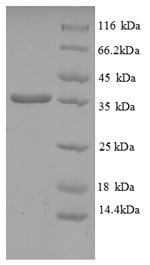 SDS-PAGE