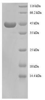 SDS-PAGE