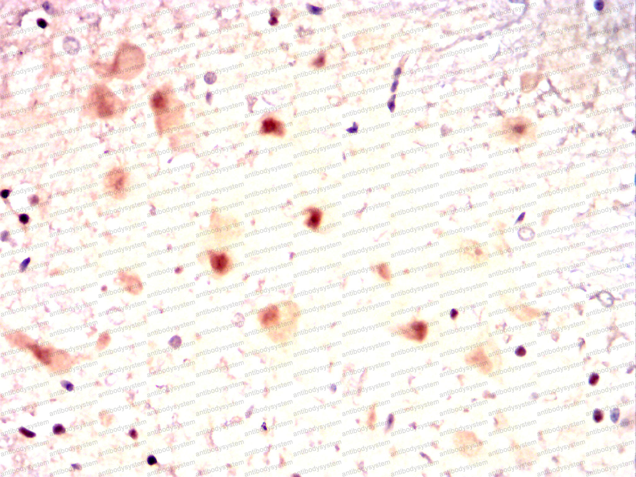 Валидация AntibodySystem RHD35301