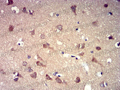 Валидация AntibodySystem RHN97101